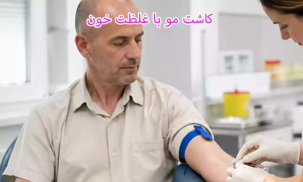 غلظت خون و کاشت مو